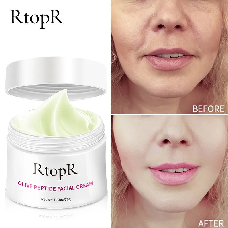 Anti Wrinkle Cream RTOPR