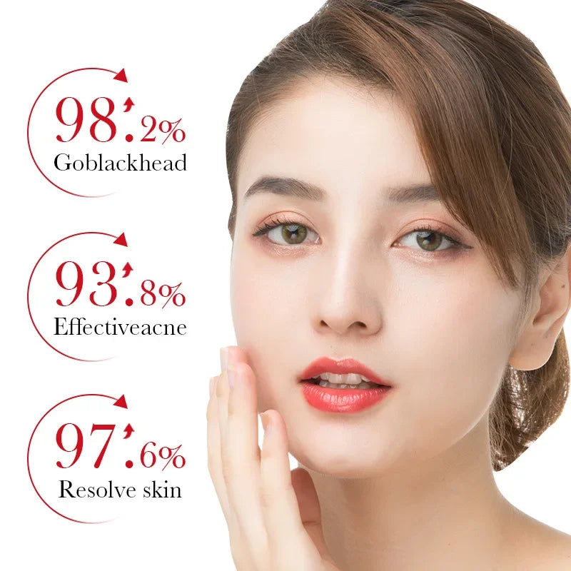 Bioaqua Salicylic Acid Acne