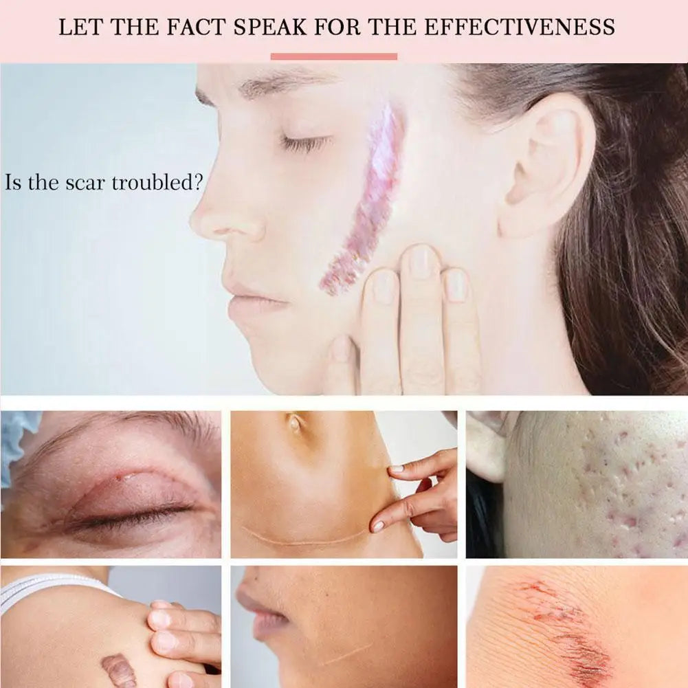 Healing Cream YOXIER