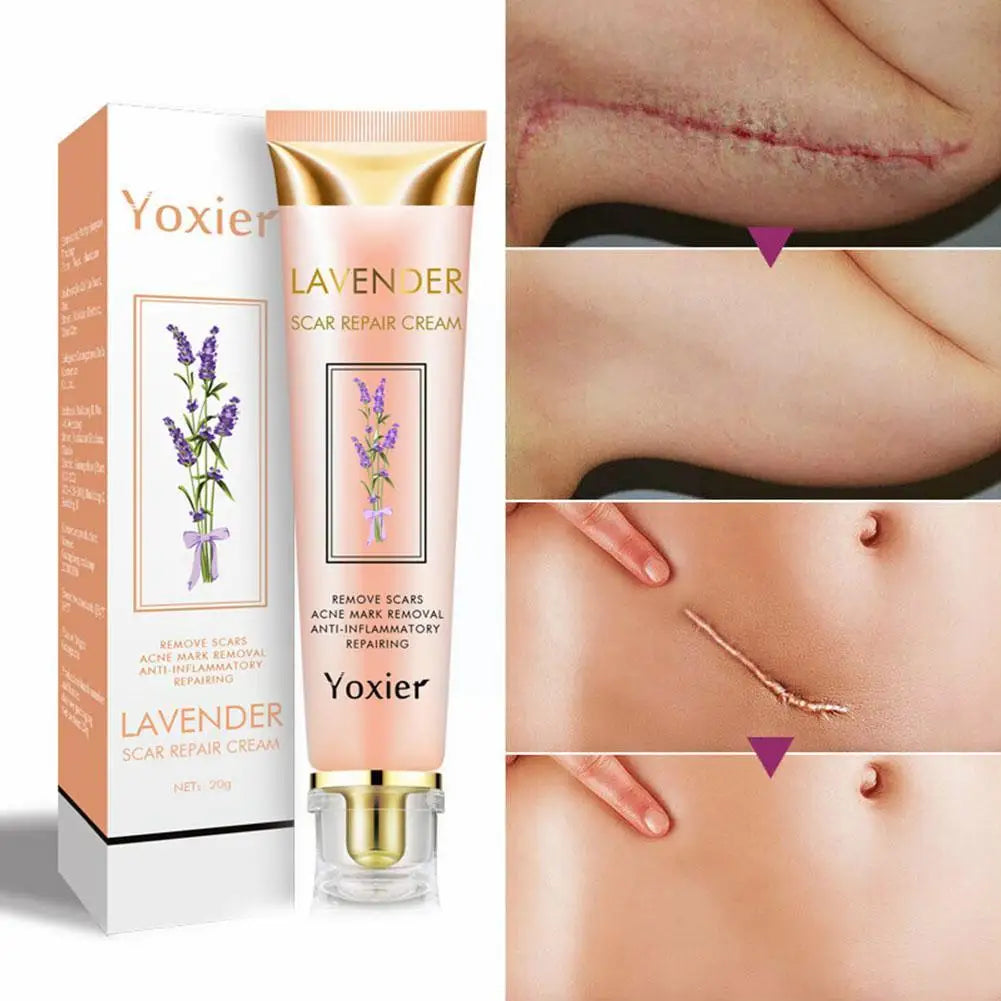 Healing Cream YOXIER