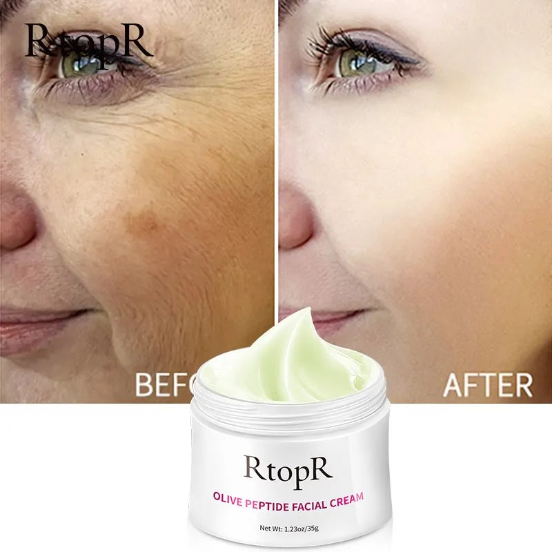 Anti Wrinkle Cream RTOPR